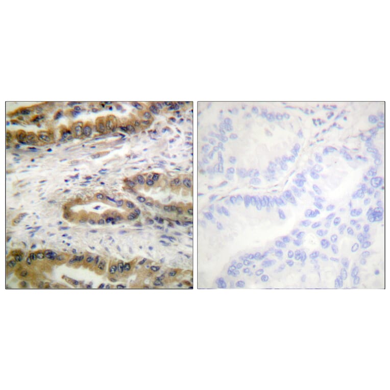 Immunohistochemistry - Anti-VEGFR2 (phospho Tyr1054) Antibody (A1014) - Antibodies.com