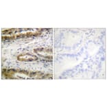 Immunohistochemistry - Anti-VEGFR2 (phospho Tyr1054) Antibody (A1014) - Antibodies.com