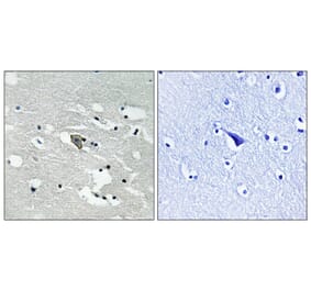 Immunohistochemistry - Anti-VEGFR1 (phospho Tyr1048) Antibody (A8198) - Antibodies.com