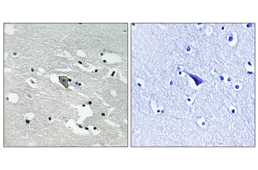 Immunohistochemistry - Anti-VEGFR1 (phospho Tyr1048) Antibody (A8198) - Antibodies.com