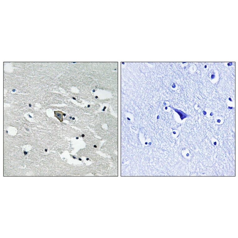 Immunohistochemistry - Anti-VEGFR1 (phospho Tyr1048) Antibody (A8198) - Antibodies.com