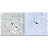Immunohistochemistry - Anti-VEGFR1 (phospho Tyr1048) Antibody (A8198) - Antibodies.com