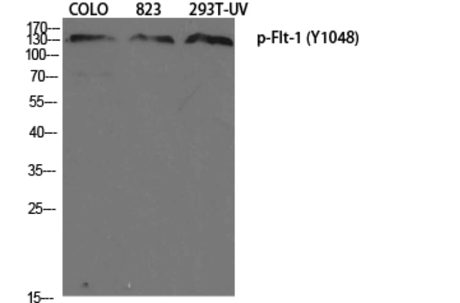 Western Blot - Anti-VEGFR1 (phospho Tyr1048) Antibody (A8198) - Antibodies.com