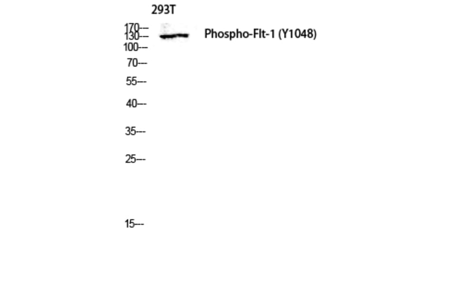 Western Blot - Anti-VEGFR1 (phospho Tyr1048) Antibody (A8198) - Antibodies.com