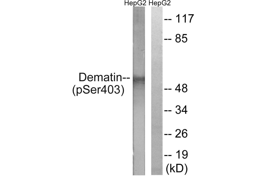 Western Blot - Anti-Dematin (phospho Ser403) Antibody (A0904) - Antibodies.com