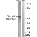 Western Blot - Anti-Dematin (phospho Ser403) Antibody (A0904) - Antibodies.com