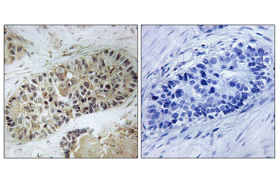 Immunohistochemistry - Anti-Artemis (phospho Ser516) Antibody (A0456) - Antibodies.com