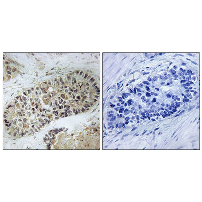 Immunohistochemistry - Anti-Artemis (phospho Ser516) Antibody (A0456) - Antibodies.com