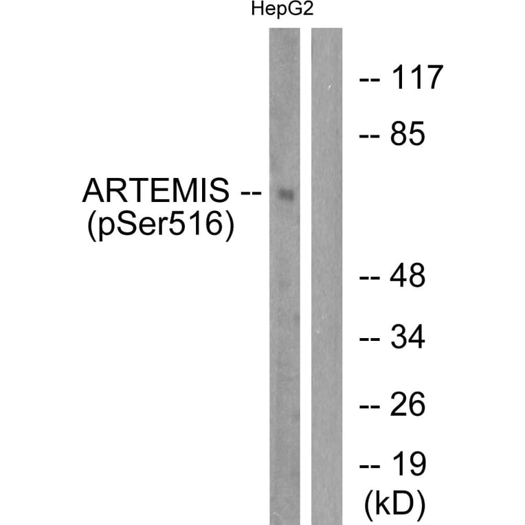 Western Blot - Anti-Artemis (phospho Ser516) Antibody (A0456) - Antibodies.com