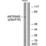 Western Blot - Anti-Artemis (phospho Ser516) Antibody (A0456) - Antibodies.com