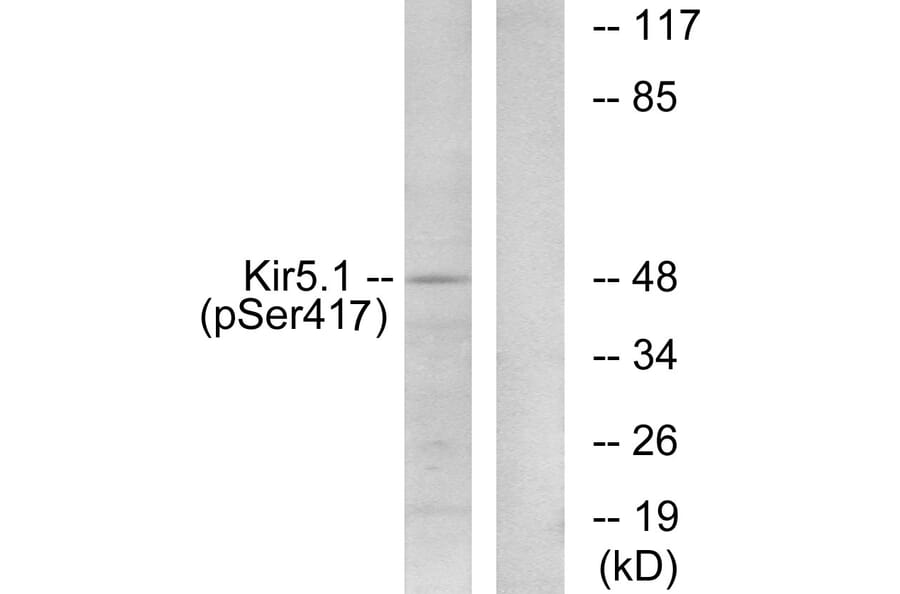 Western Blot - Anti-Kir5.1 (phospho Ser417) Antibody (A1083) - Antibodies.com