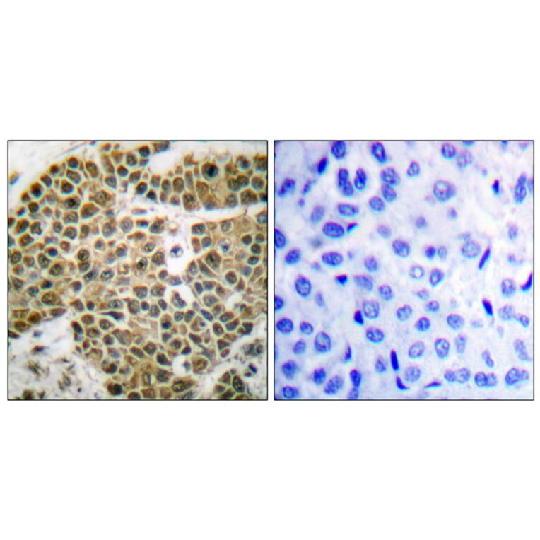Immunohistochemistry - Anti-NF kappa B p105 / p50 Antibody (B0021) - Antibodies.com
