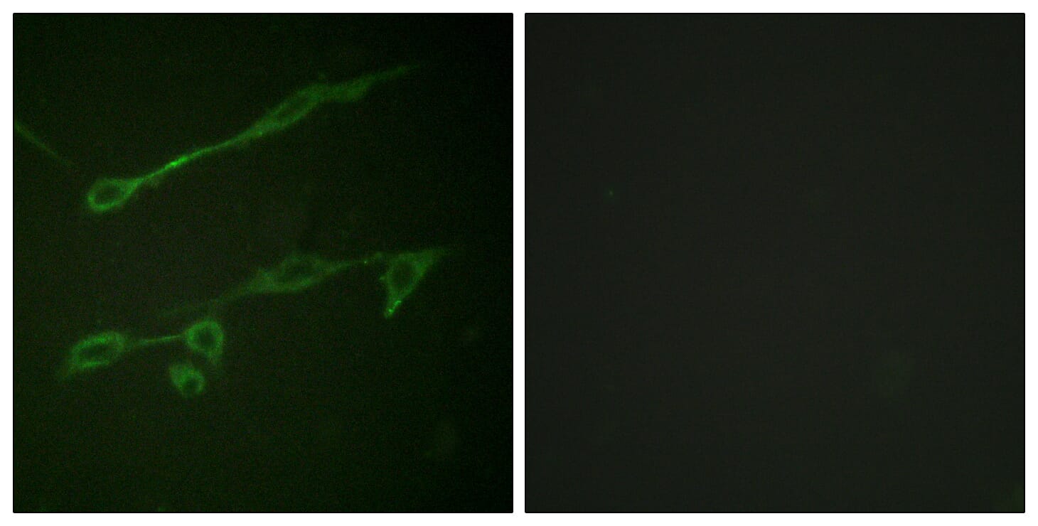 Immunofluorescence analysis of NIH/3T3 cells using Anti-VAV2 (phospho Tyr142) Antibody. The right hand panel represents a negative control, where the antibody was pre-incubated with the immunising peptide.