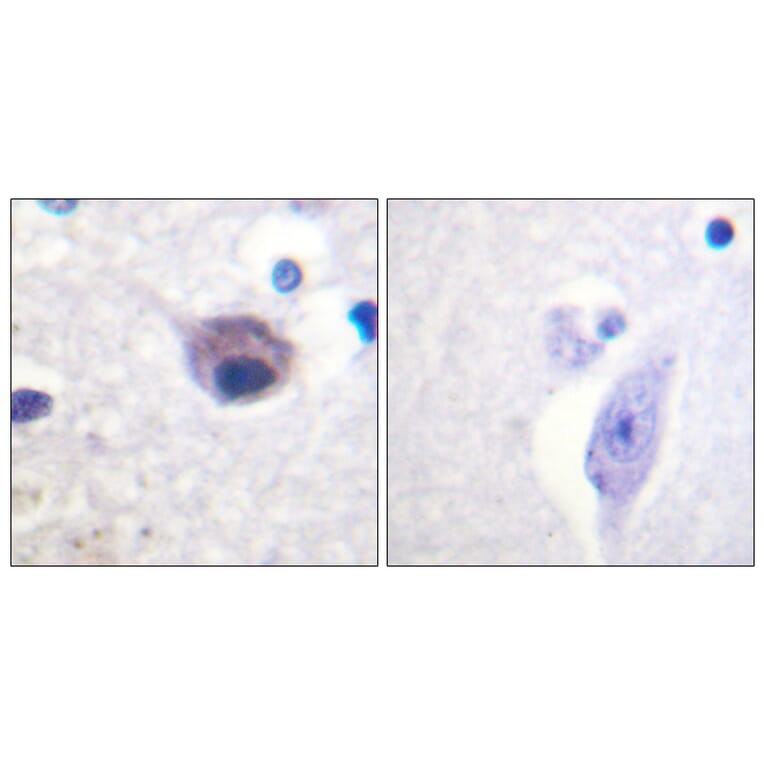 Immunohistochemistry - Anti-VAV2 (phospho Tyr142) Antibody (A1241) - Antibodies.com