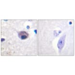 Immunohistochemistry - Anti-VAV2 (phospho Tyr142) Antibody (A1241) - Antibodies.com