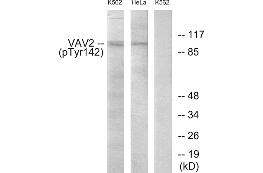 Western Blot - Anti-VAV2 (phospho Tyr142) Antibody (A1241) - Antibodies.com
