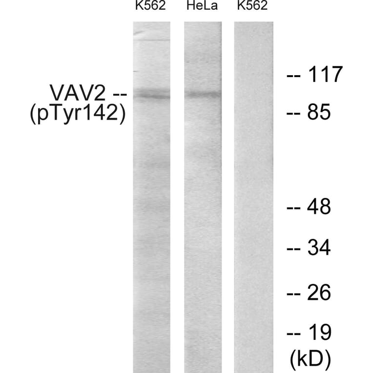 Western Blot - Anti-VAV2 (phospho Tyr142) Antibody (A1241) - Antibodies.com