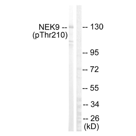 Western Blot - Anti-NEK9 (phospho Thr210) Antibody (A1159) - Antibodies.com