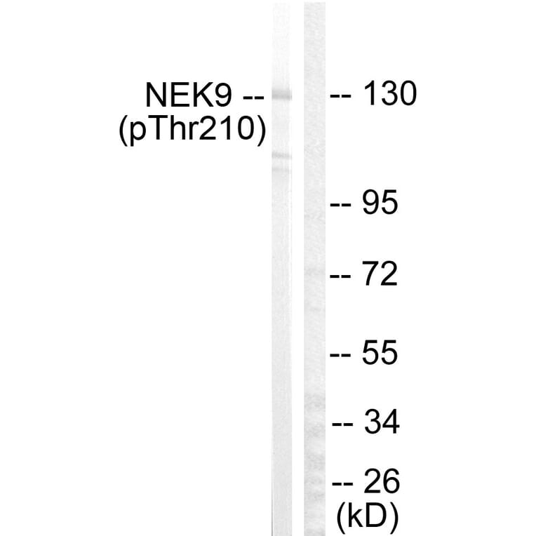 Western Blot - Anti-NEK9 (phospho Thr210) Antibody (A1159) - Antibodies.com