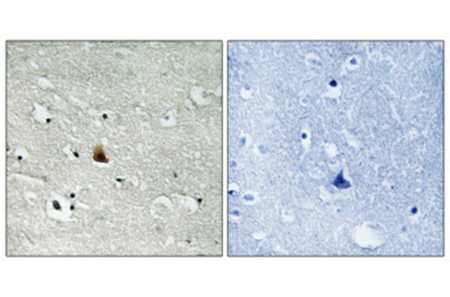 Immunohistochemistry - Anti-NEK9 (phospho Thr210) Antibody (A1159) - Antibodies.com