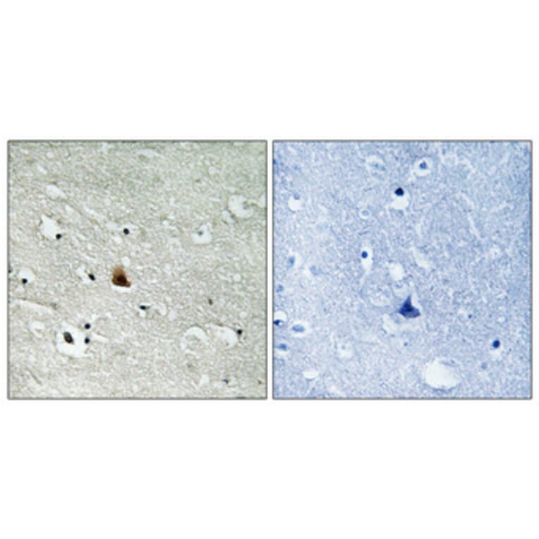 Immunohistochemistry - Anti-NEK9 (phospho Thr210) Antibody (A1159) - Antibodies.com