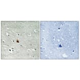 Immunohistochemistry - Anti-NEK9 (phospho Thr210) Antibody (A1159) - Antibodies.com