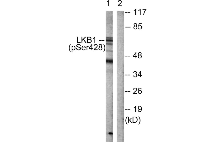 Western Blot - Anti-LKB1 (phospho Ser428) Antibody (A0672) - Antibodies.com