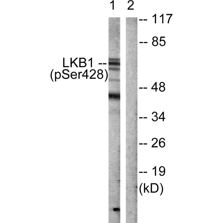 Western Blot - Anti-LKB1 (phospho Ser428) Antibody (A0672) - Antibodies.com