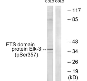Western Blot - Anti-Elk3 (phospho Ser357) Antibody (A0923) - Antibodies.com