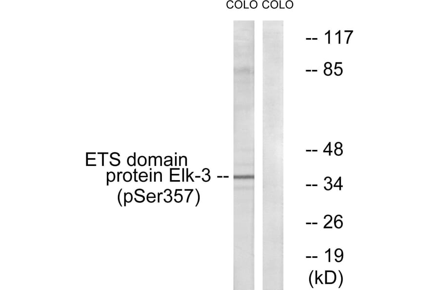 Western Blot - Anti-Elk3 (phospho Ser357) Antibody (A0923) - Antibodies.com