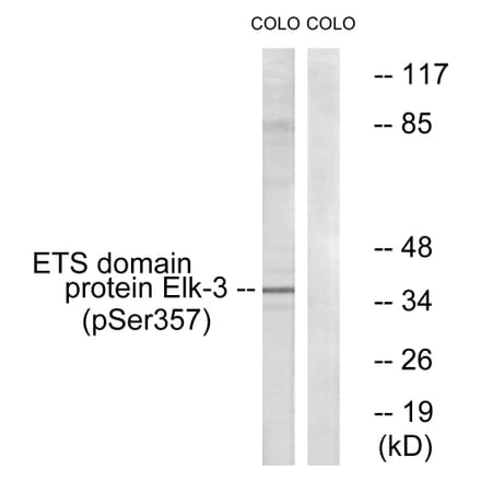 Western Blot - Anti-Elk3 (phospho Ser357) Antibody (A0923) - Antibodies.com