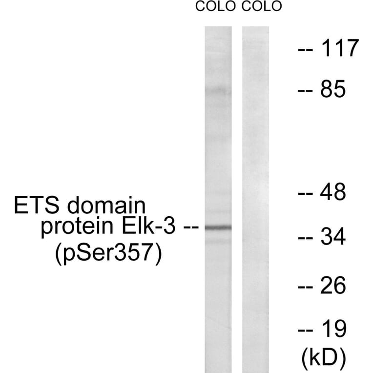 Western Blot - Anti-Elk3 (phospho Ser357) Antibody (A0923) - Antibodies.com