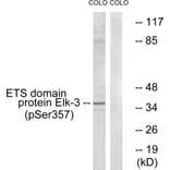 Western Blot - Anti-Elk3 (phospho Ser357) Antibody (A0923) - Antibodies.com