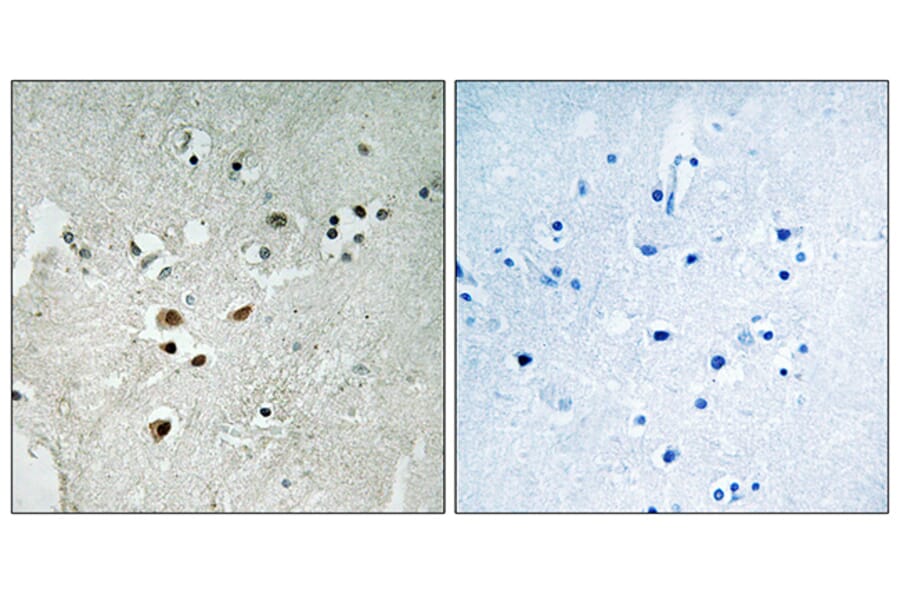 Immunohistochemistry - Anti-Elk3 (phospho Ser357) Antibody (A0923) - Antibodies.com