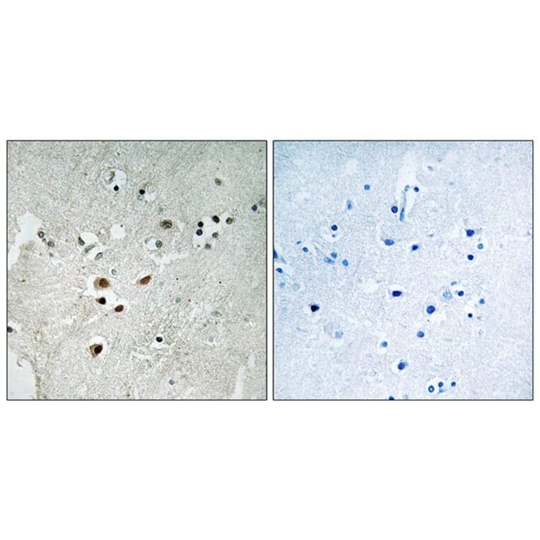 Immunohistochemistry - Anti-Elk3 (phospho Ser357) Antibody (A0923) - Antibodies.com