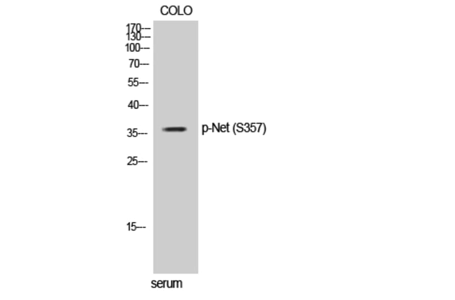 Western Blot - Anti-Elk3 (phospho Ser357) Antibody (A0923) - Antibodies.com