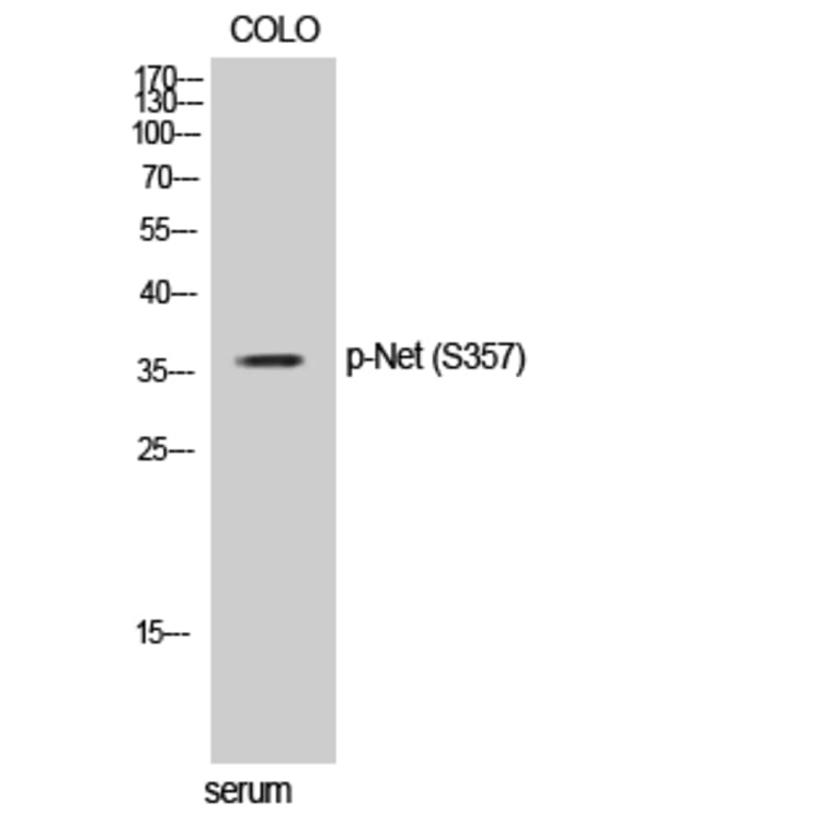 Western Blot - Anti-Elk3 (phospho Ser357) Antibody (A0923) - Antibodies.com