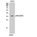 Western Blot - Anti-Elk3 (phospho Ser357) Antibody (A0923) - Antibodies.com