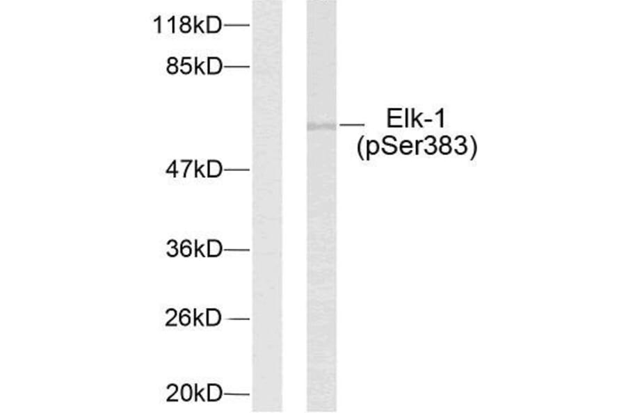 Western Blot - Anti-Elk1 (phospho Ser383) Antibody (A7068) - Antibodies.com