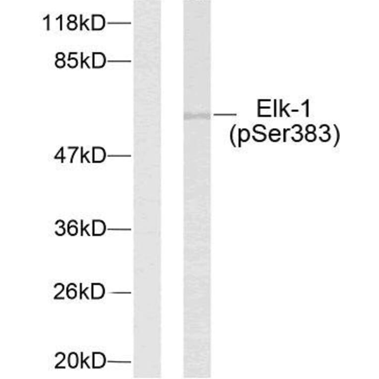 Western Blot - Anti-Elk1 (phospho Ser383) Antibody (A7068) - Antibodies.com