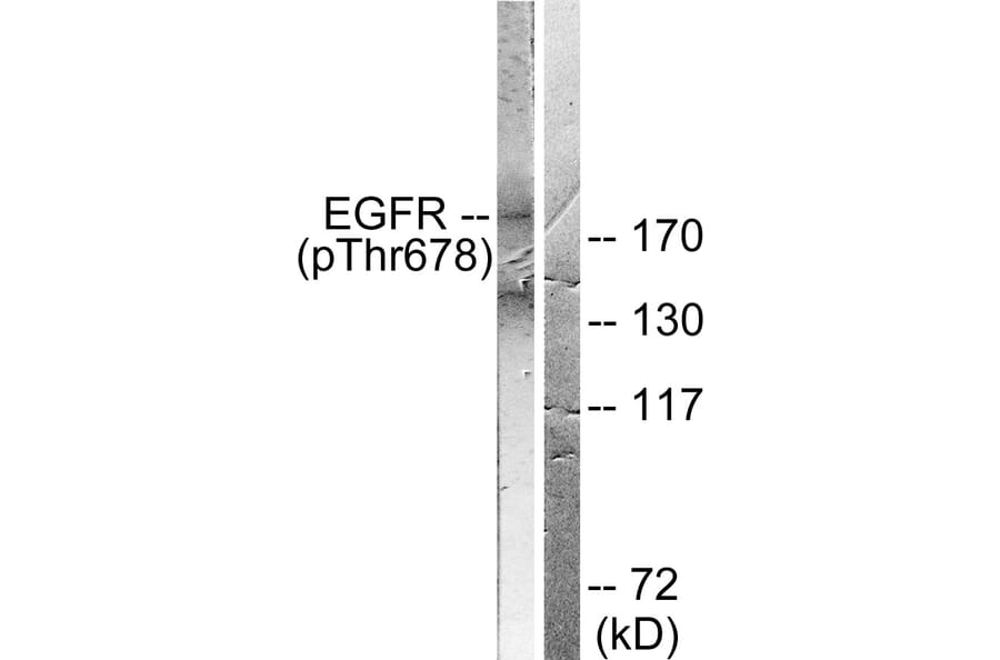 Western Blot - Anti-EGFR (phospho Thr678) Antibody (A0008) - Antibodies.com