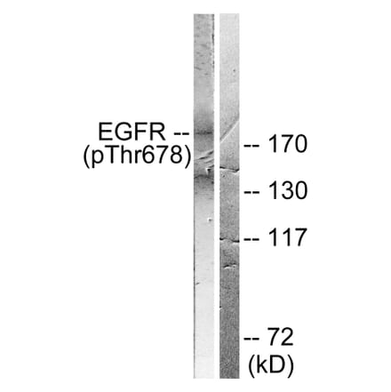 Western Blot - Anti-EGFR (phospho Thr678) Antibody (A0008) - Antibodies.com