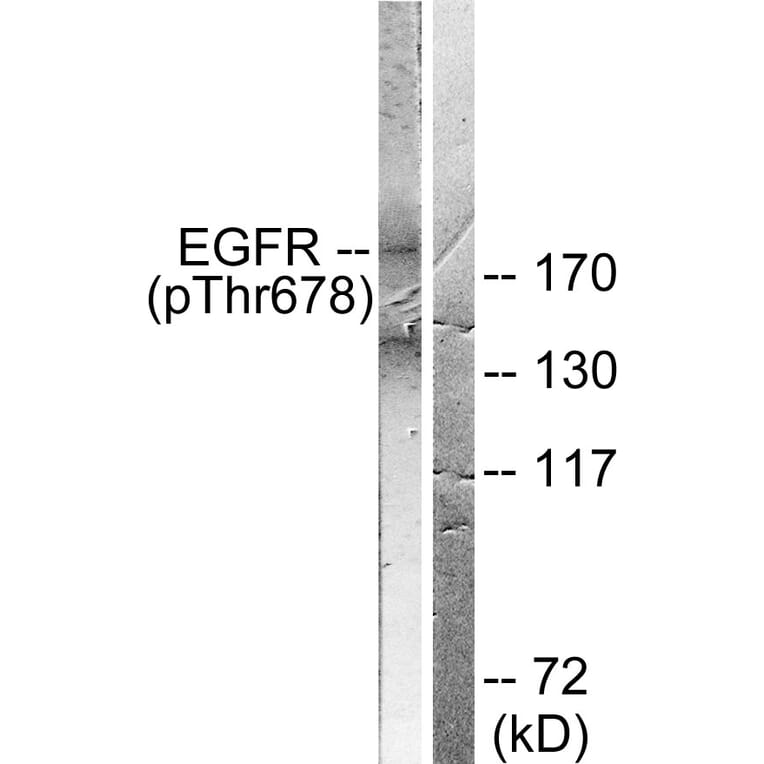 Western Blot - Anti-EGFR (phospho Thr678) Antibody (A0008) - Antibodies.com