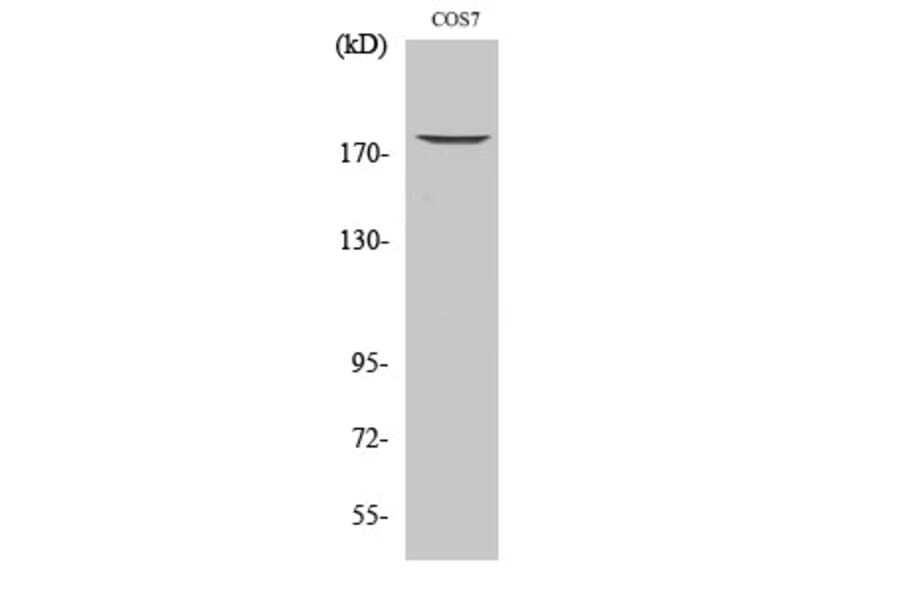 Western Blot - Anti-EGFR (phospho Thr678) Antibody (A0008) - Antibodies.com