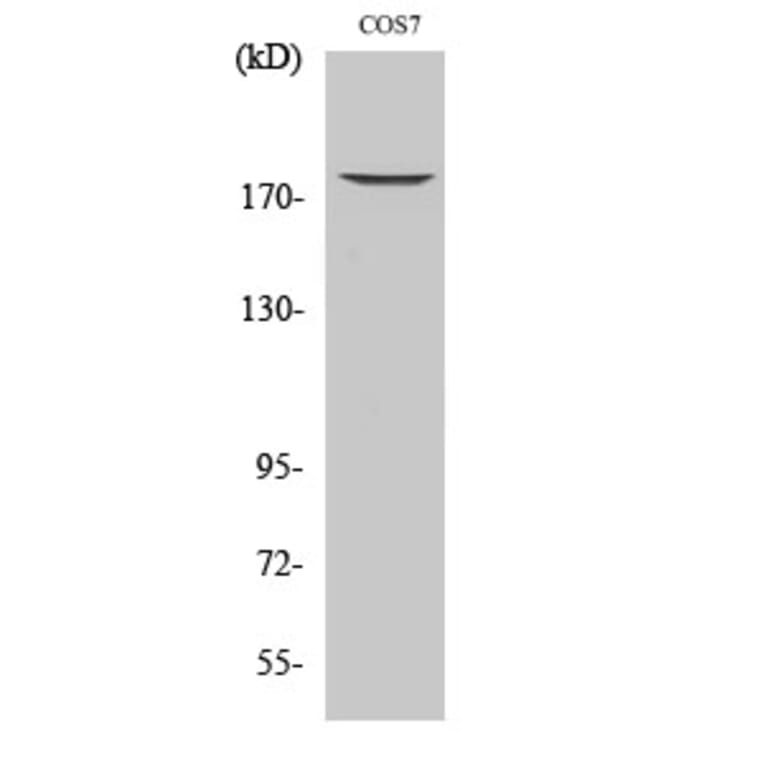 Western Blot - Anti-EGFR (phospho Thr678) Antibody (A0008) - Antibodies.com