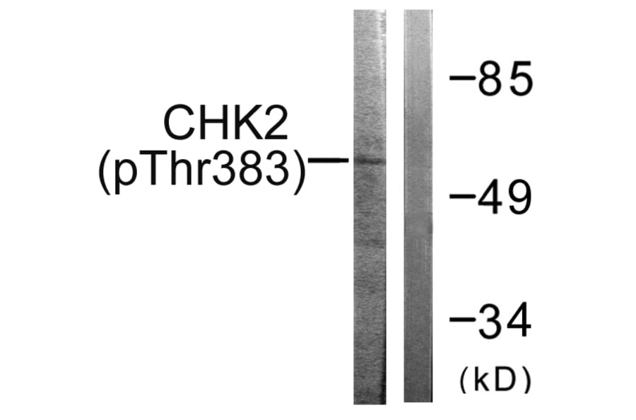 Western Blot - Anti-Chk2 (phospho Thr383) Antibody (A0784) - Antibodies.com