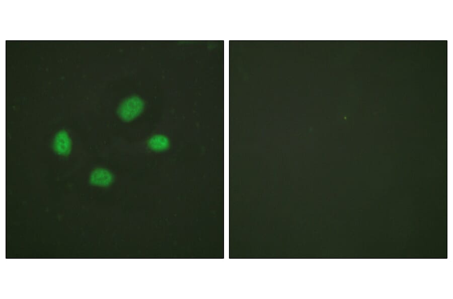 Immunofluorescence - Anti-Chk2 (phospho Thr383) Antibody (A0784) - Antibodies.com