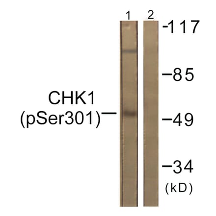 Western Blot - Anti-Chk1 (phospho Ser301) Antibody (A0862) - Antibodies.com