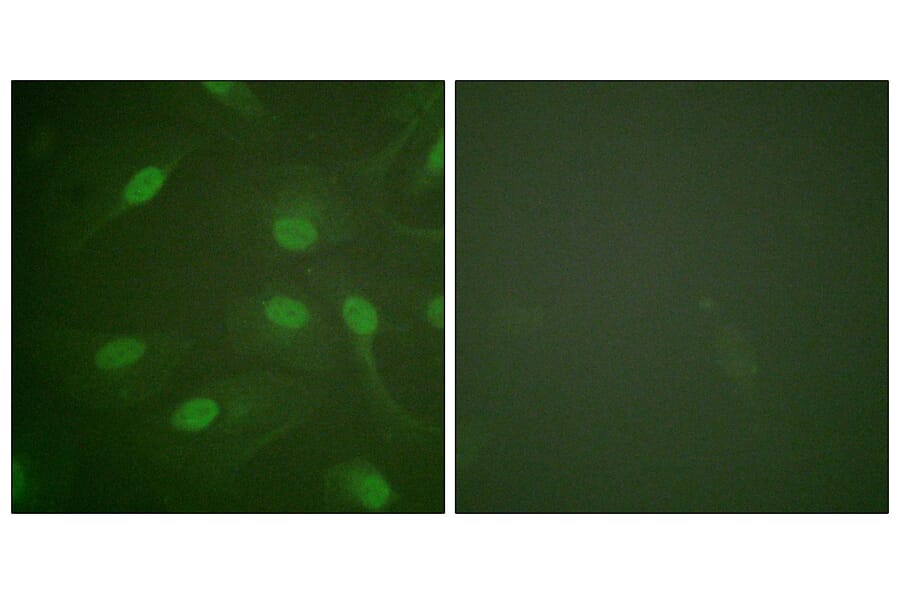 Immunofluorescence - Anti-Chk1 (phospho Ser301) Antibody (A0862) - Antibodies.com