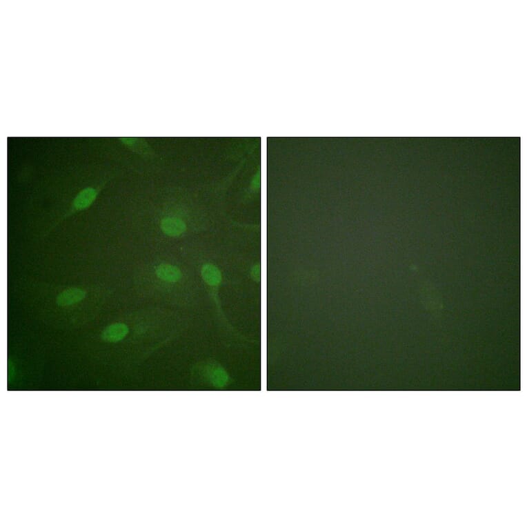 Immunofluorescence - Anti-Chk1 (phospho Ser301) Antibody (A0862) - Antibodies.com